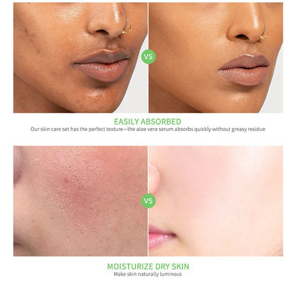 Aloe Vera Brightening & Moisturizing Kit