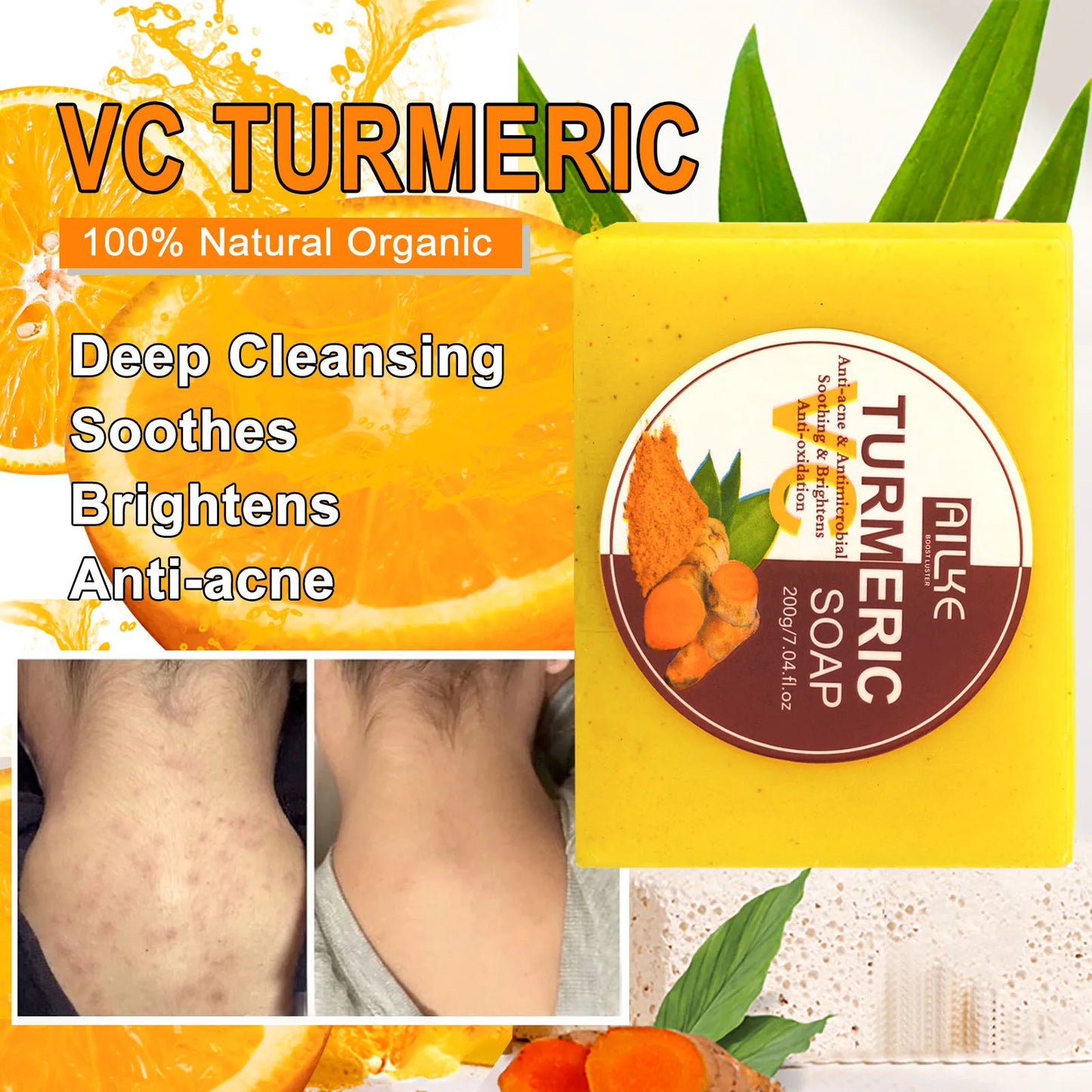 AILKE Organic Turmeric Whitening Set – Vitamin C Brightening & Anti‑Acne Care