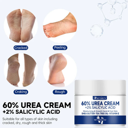 SUYARUN 60% Urea Foot Cream – Intensive Heel Hydration