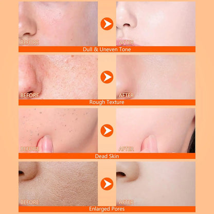 Body Keratin Care Kojic Acid Turmeric Spray – Exfoliating & Hydrating