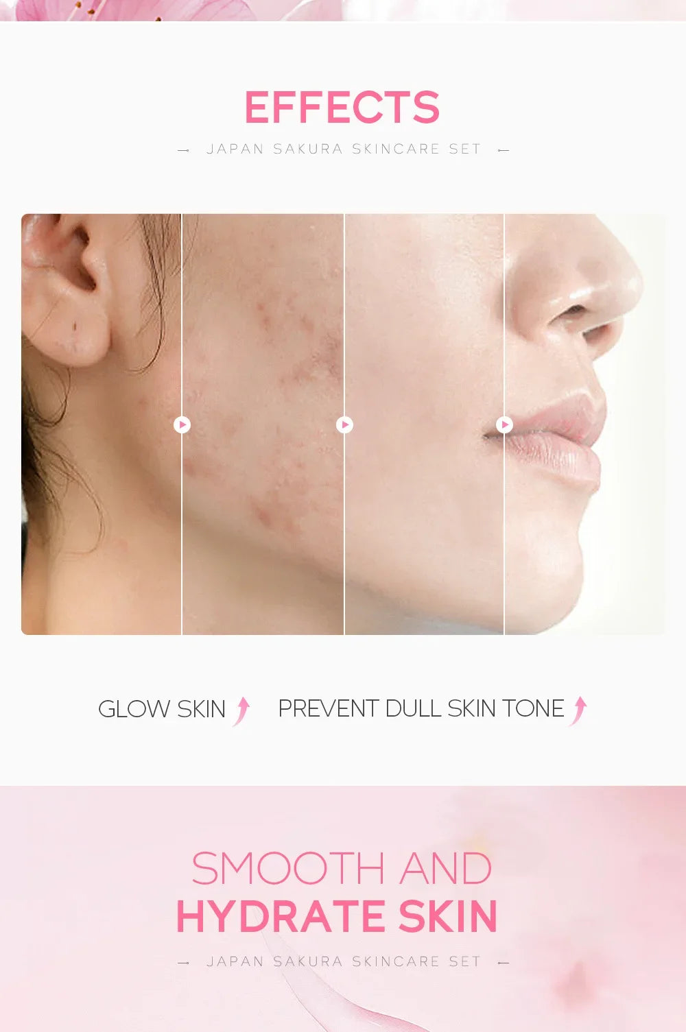 LAIKOU Sakura Skincare Set – 5PCS Moisturizing & Brightening Kit
