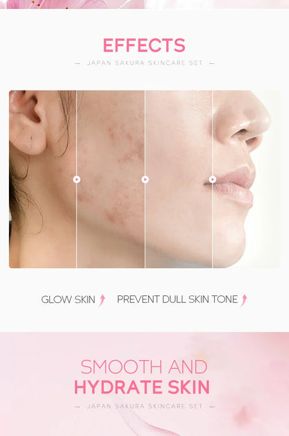 LAIKOU Sakura Skincare Set – 5PCS Moisturizing & Brightening Kit